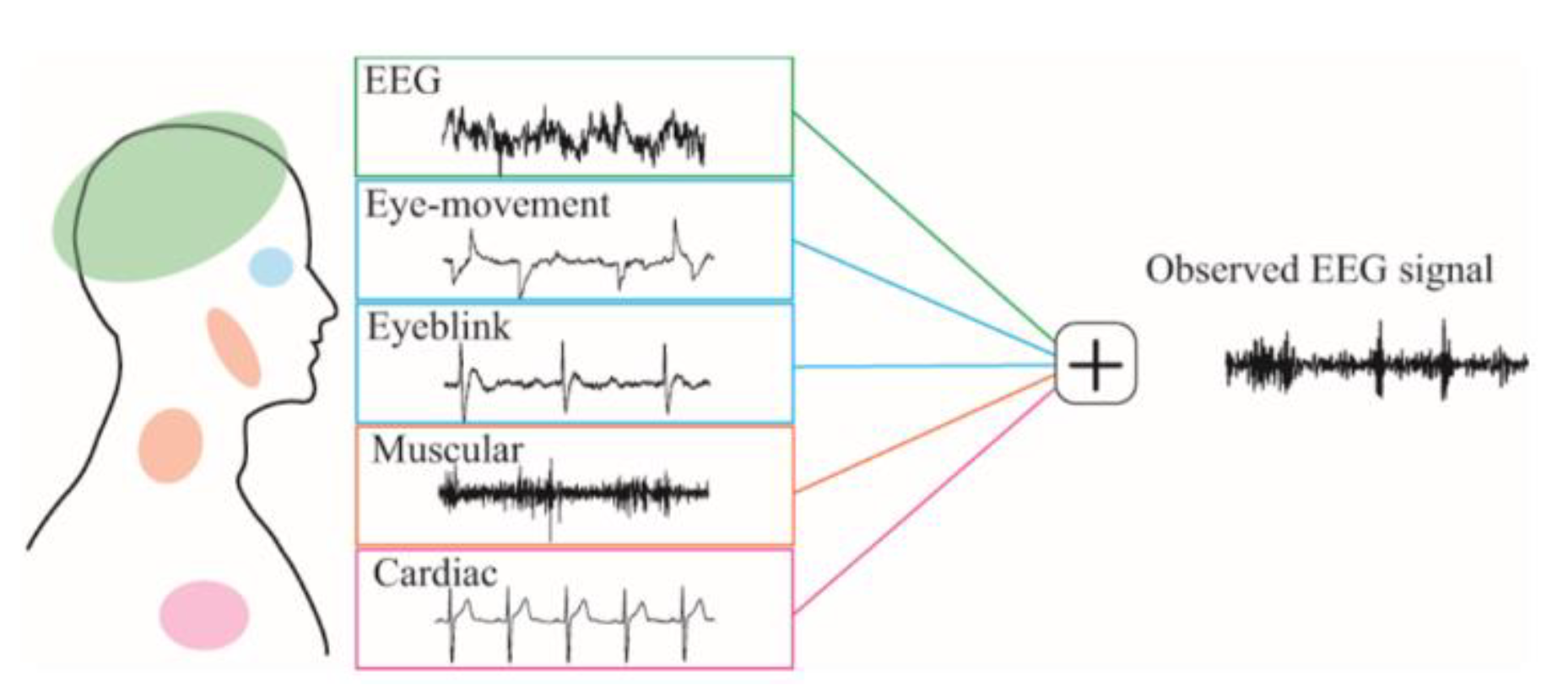EEG artifact rejection workflow